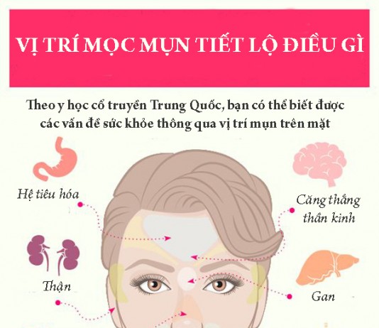 Vị trí mụn mọc trên mặt ngầm cảnh cáo vấn đề sức khỏe
