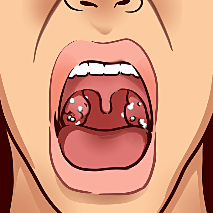 4.8 điều cơ thể muốn cảnh báo khi bạn thấy vị lạ trong miệng