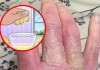Trời nắng nóng nên cẩn thận với căn bệnh viêm da mà ai cũng có thể gặp phải trong mùa hè