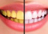 Phải làm sao khi răng ố vàng?