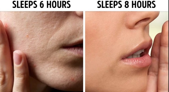 Làn da của bạn sẽ cải thiện đáng kể  Thời gian bạn ngủ cũng là lúc làn da được nghỉ ngơi, phục hồi tổn thương và tái tạo da. Ngủ đủ giấc sẽ giúp làn da mịn màng và căng tràn sức sống.