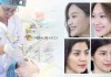 Multi Layer – Xóa nhăn vùng mũi má, da tươi trẻ sắc xuân