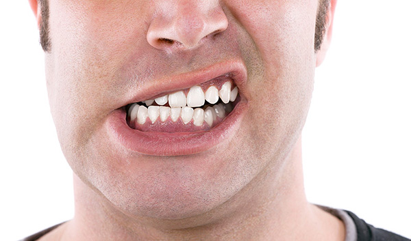 10. 5 thói quen gây hại đến răng bạn không thể ngờ đến2