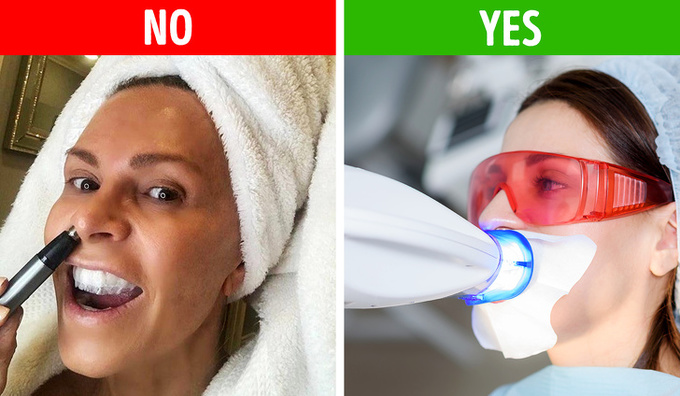 Dùng miếng dán trắng răng  Đây là sản phẩm không được các nha sĩ khuyên dùng bởi chúng dễ làm yếu men răng. Để làm trắng răng, tốt nhất, bạn nên tìm tới cơ sở nha khoa uy tín.