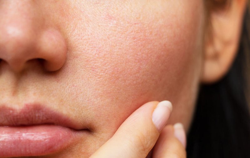 5 vấn đề phổ biến về da và cách chữa trị nhanh chóng2