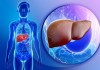 Thói quen giúp bảo vệ và giải độc gan