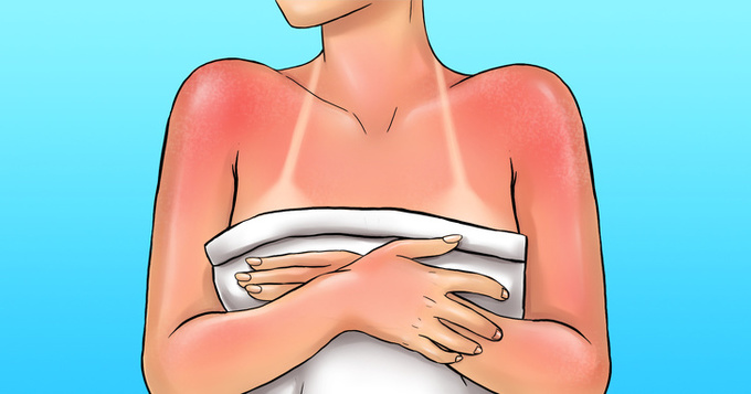 Chống nắng đầy đủ  Ánh nắng mặt trời là một trong những tác nhân gây lão hóa da hàng đầu. Để bảo vệ da, bạn nên hạn chế tắm nắng. Sử dụng kem chống nắng thường xuyên sẽ bảo vệ làn da khỏi tác hại của tia UV.