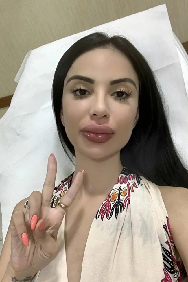 Đôi môi của Jennifer đã cảnh tỉnh cô ngừng phá hủy nhan sắc, sức khỏe của mình.