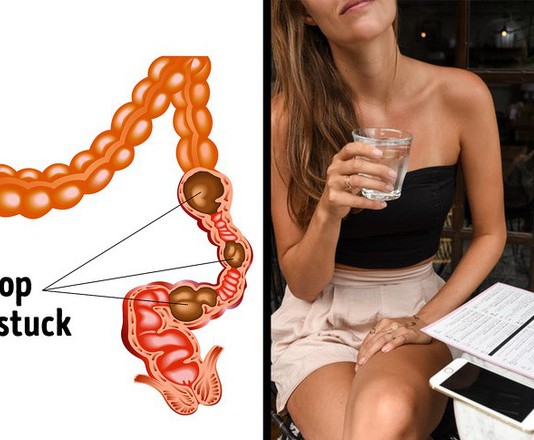 Những cách giải quyết triệt để giúp chấm dứt tình trạng táo bón dai dẳng