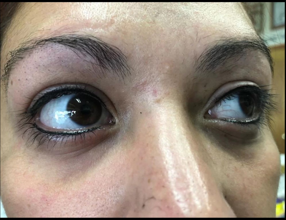 Mọi hình xăm xung quanh hốc mắt đều được xem là bất hợp pháp tại bang Georgia, Mỹ. Điều này bao gồm cả xăm mí mắt và xăm lông mày.