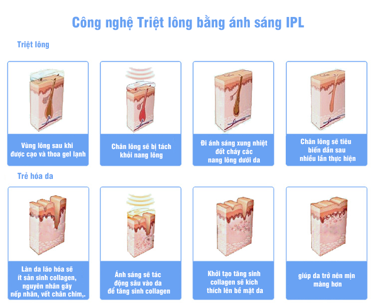 ipl triet