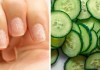 8 cách khắc phục móng tay giòn yếu, nhiễm nấm