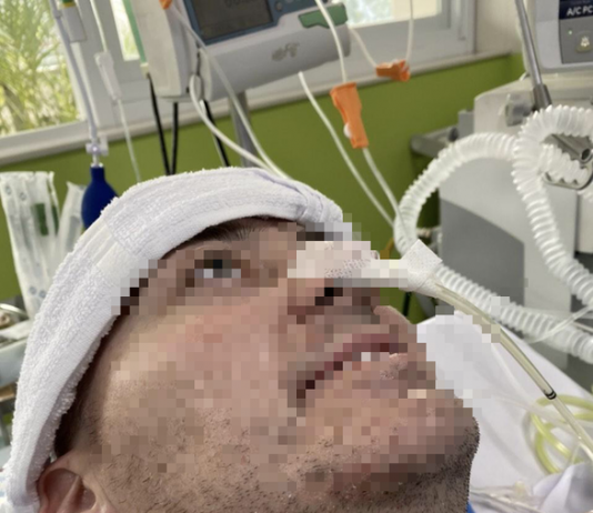 Bệnh nhân phi công người Anh đã ngồi dậy được, tự bấm nút điều chỉnh giường