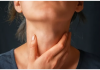 4 kiểu người có nguy cơ cao mắc ung thư tuyến giáp nhất