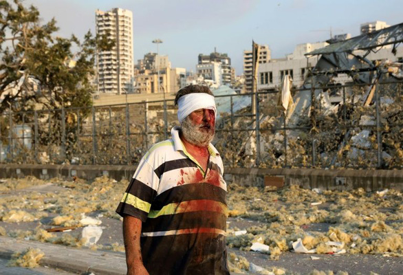 lebanon-beirut-wounded-man-afp-1596584814946855661223