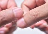 4 dấu hiệu trên móng tay “chỉ điểm” trong người bạn đang có mầm bệnh