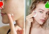 Chuyên gia da liễu chỉ điểm 7 mẹo làm đẹp tệ hại