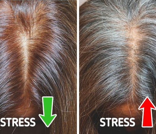 6 nguyên nhân khiến người trẻ tuổi có tóc bạc sớm