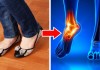 6 loại giày dép gây hại nghiêm trọng cho cơ thể nhưng ai cũng sở hữu