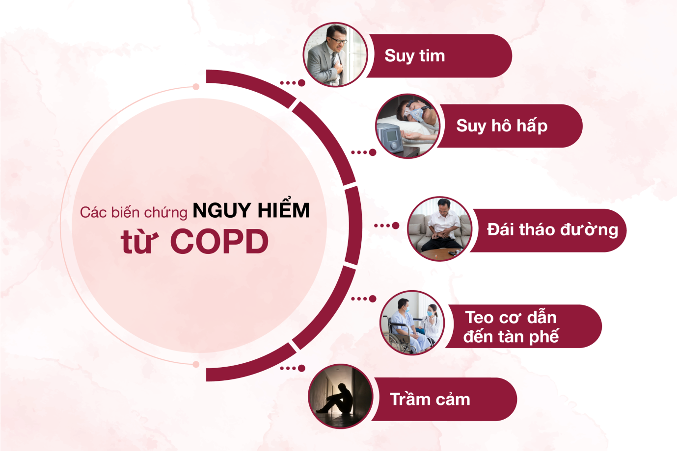 Bệnh phổi tắc nghẽn mãn tính (COPD) gây ra những biến chứng nguy hiểm, nên cần tuân thủ điều trị tốt. Ảnh: internet