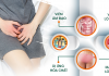 Ngứa vùng kín – Dấu hiệu bệnh viêm nhiễm phụ khoa nguy hiểm